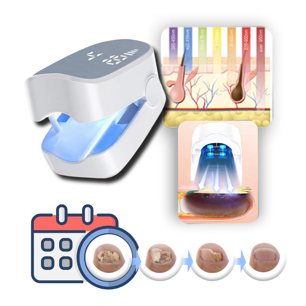Laser Nail Treatment Device with Cold Laser and Blue Light, Clip-On Design