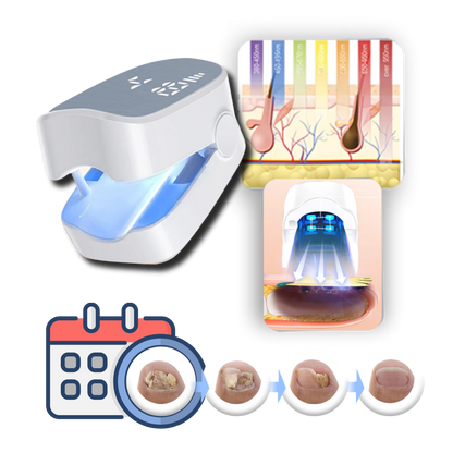 Laser Nail Treatment Device with Cold Laser and Blue Light, Clip-On Design