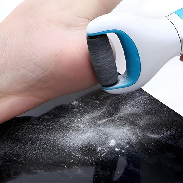 Rechargeable Callus Remover with Rotating Abrasive Head for Smooth Feet