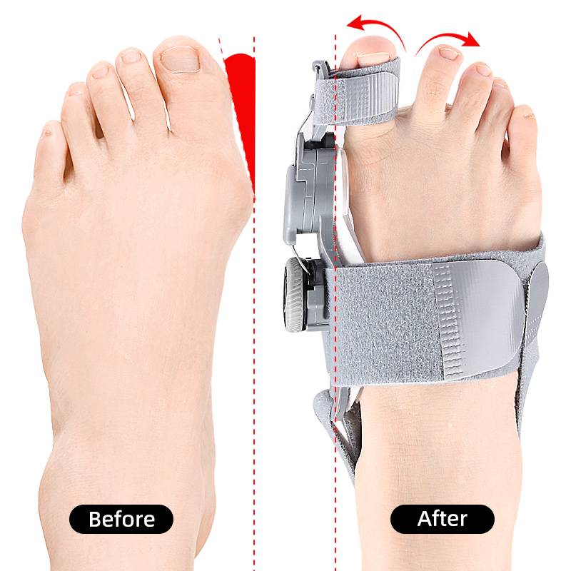 Adjustable Bunion Corrector with Silicone Cushioning and Heel Strap, Universal Size