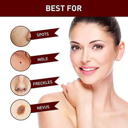 Skin Tag Remover Solution with Tea Tree Oil and Arborvitae Extract