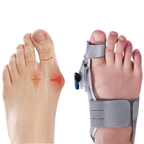 Adjustable Bunion Corrector with Silicone Cushioning and Heel Strap, Universal Size