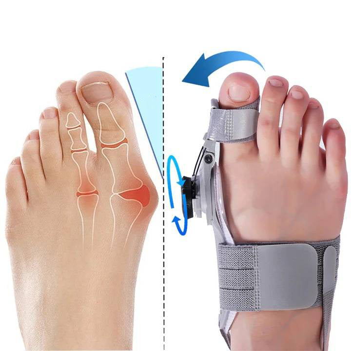 Adjustable Bunion Corrector with Silicone Cushioning and Heel Strap, Universal Size